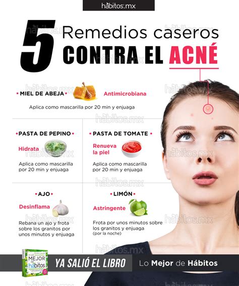 5 Remedios Caseros Contra El Acné Hábitos Health Coaching
