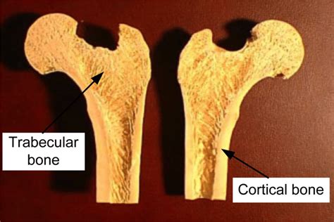 Cross Section Of A Bone Cross Section Through A Molar Tooth Showing