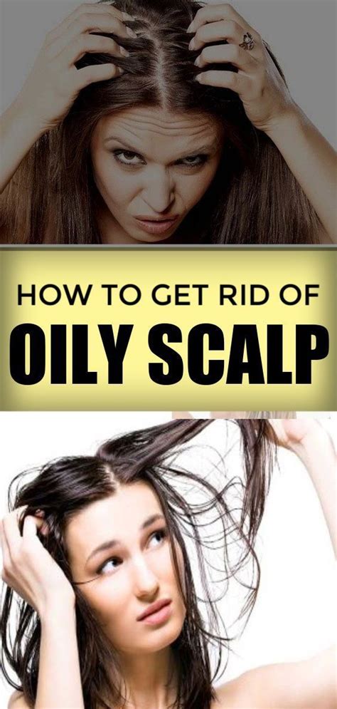 How To Get Rid Of Oily Scalp And Greasy Hair Home Remedies Oilyhair How