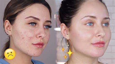 Best Treatment For Dark Spots On Face Recibeauty