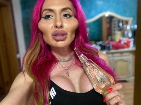 Real Life Barbie Andrea Ivanova With The Biggest Lips In The World Shows Off Huge New Pout After