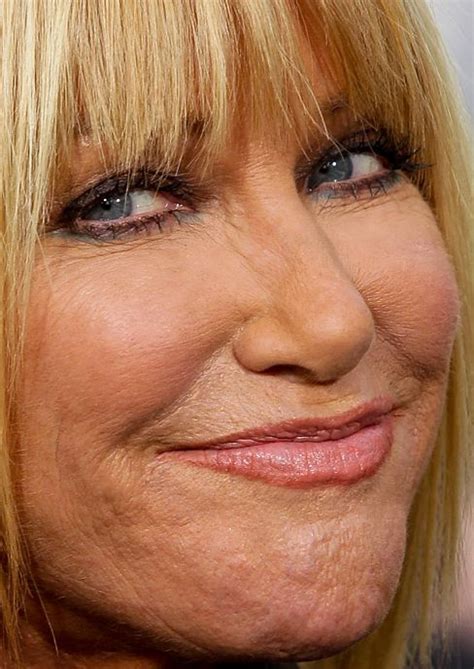 Suzanne Somers Plastic Surgery Celebrity Plastic Surgery Online