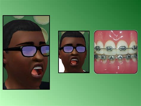 The Sims Resource Braces