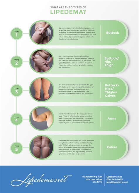 Definitions Of Lipedema Lipoedema And Lipodema