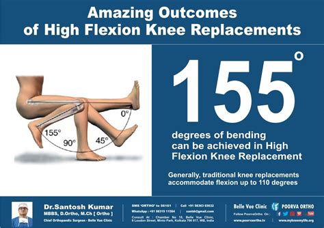 Amazing Outcomes Of High Flexion Knee Replacement Helpline 91