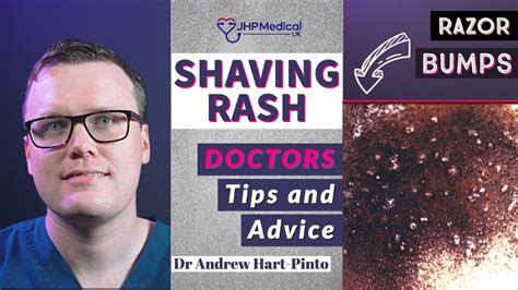 How To Avoid And Treat SHAVING RASH Doctors Tips And Advice YouTube