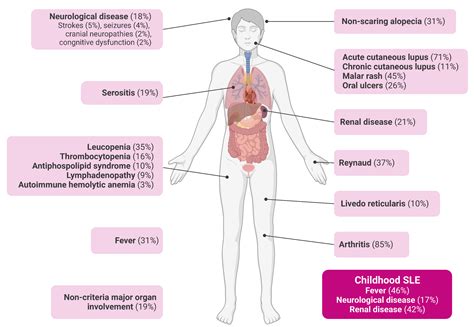 Clinical Considerations In The Diagnosis And Management Of Systemic