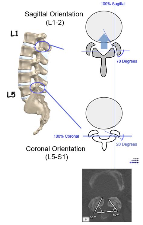 Lumbar Spine Anatomy Spine Orthobullets