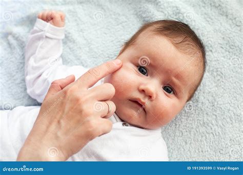 Baby With Atopic Dermatitis Getting Cream Put Care And Prevention Of