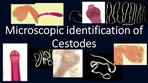 Microscopic Identification Of Cestodescestodesmlshelminths