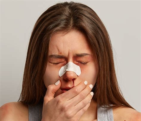Nose Bleed Epistaxis Causes Diagnosis And Treatment Dr Sharad Ent