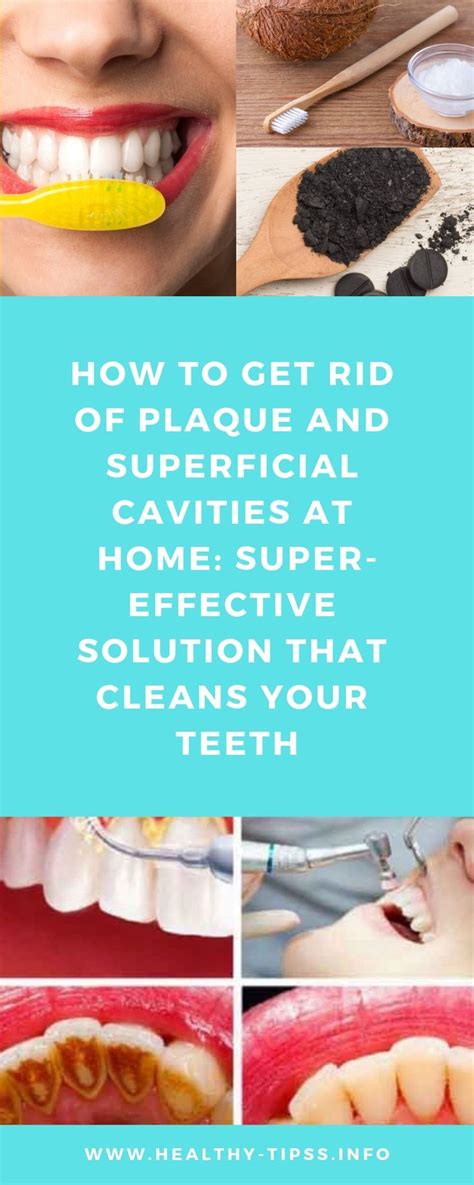 If you want to know about some of the different dental learn about your options. How to Get Rid of Plaque and Superficial Cavities at Home ...
