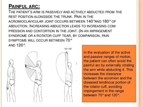 Shoulder Examination Pt Master Guide