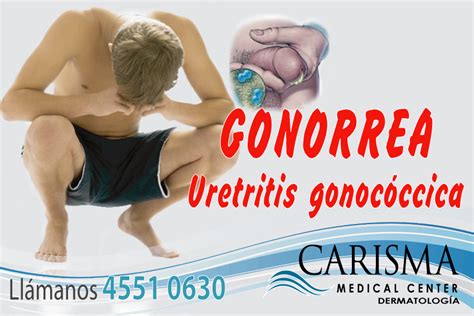 Centro Dermatológico Dr Ramírez Medina Sección Hombres GONORREA URETRITIS GONOCÓCICA EN EL