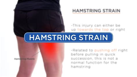 Hamstring Strain Diagnosis Youtube
