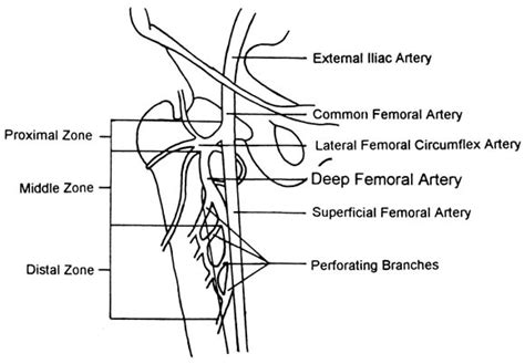 Posterior Approach To The Deep Femoral Artery Journal Of Vascular Surgery