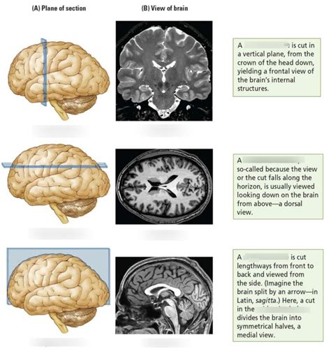 Brain Slicing Diagram Quizlet