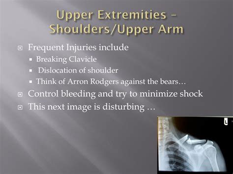 Ppt Injuries To The Extremities Powerpoint Presentation Free
