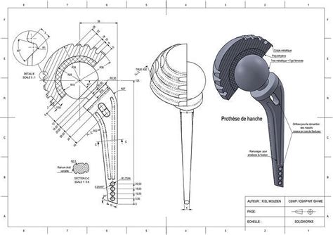 Prosthetic Hip Joint 3d Model 3d Printable Cgtrader