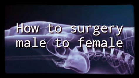 Sex Reassignment Surgery Animated Sex Change Male To Female