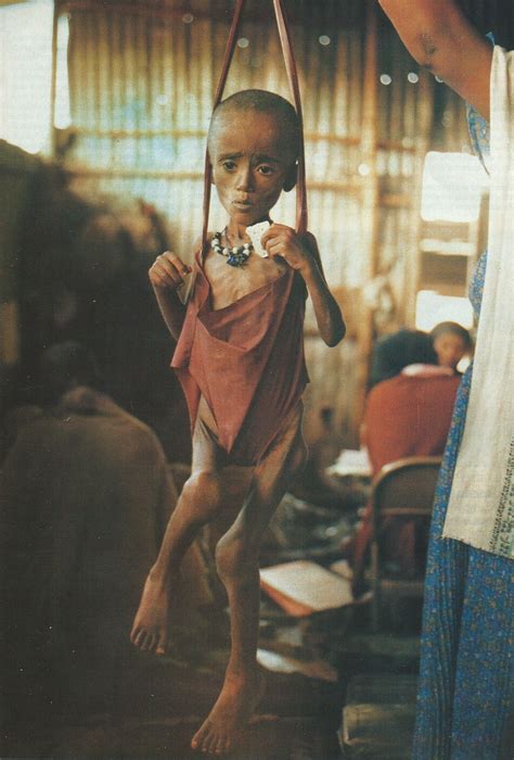 Emaciated Child / Starvation Child Stock Photos & Starvation Child Stock  / Your child 
