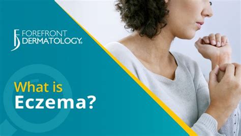 Eczema What You Need To Know Forefront Dermatology