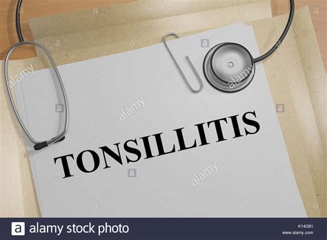 Swollen Tonsils High Resolution Stock Photography And Images Alamy