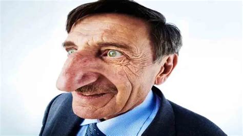 Viral News Man Have World Longest Nose Viral News ವಿಶ್ವದ ಅತ್ಯಂತ