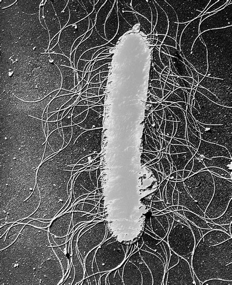 Tem Of The Bacteria Photograph By A Dowsett Public Health England