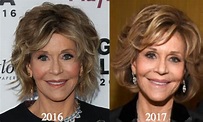 Mavis Leno 2017 Photos Plastic Surgery Before And After | celebrity ...