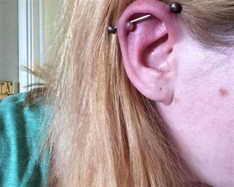 Cartilage Piercing Bump Vs Keloid ~ Piercing Ideas