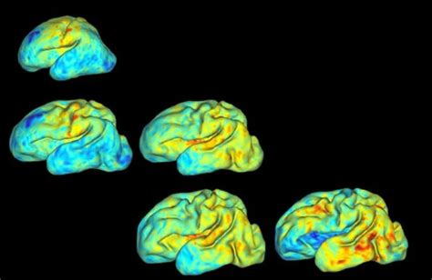 3d Mapping Babies Brains Neuroscience News