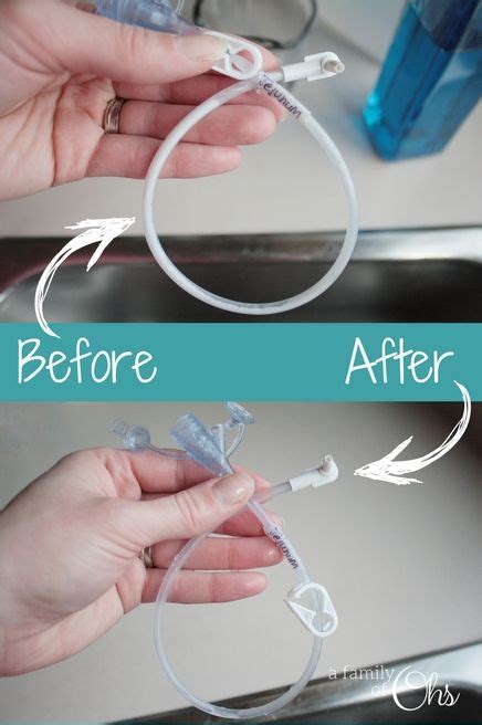 How To Cleaning Feeding Tube Extensions The Safe And Effective Way