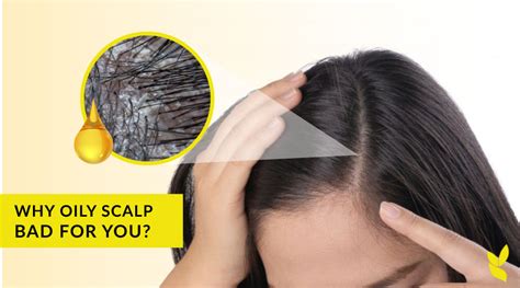 Why Is An Oily Scalp Bad For You And 3 Tips How To Treat It Healthy