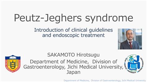 Peutz Jeghers Syndrome Introduction Of Clinical Guidelines And