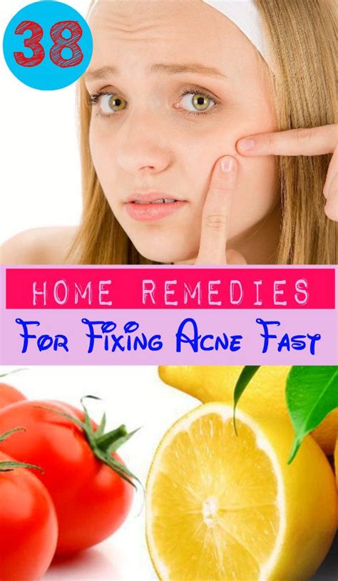 38 Home Remedies For Fixing Acne Fast Acne Remedies Home Remedies