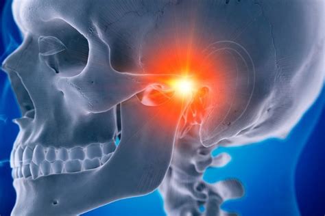 Trastorno temporomandibular qué es causas y soluciones