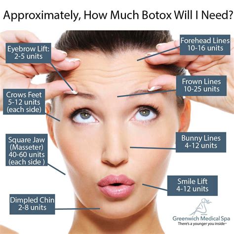 Can You Work Out 12 Hours After Botox Elicia Kearney