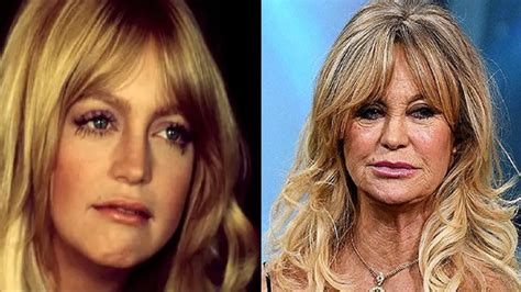 Prayers 75 Year Old Goldie Hawn Begs For The Help As She Is Fighting For Her Life Due To This