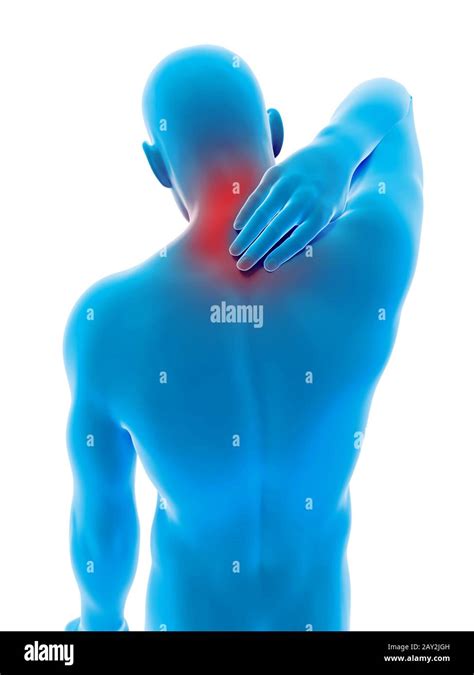 Medical 3d Illustration Male Having Pain In The Neck Stock Photo Alamy