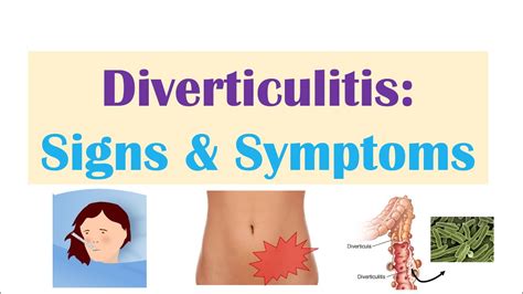 Everything You Need To Know About Diverticulitis Drharshsheth