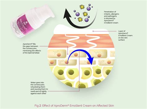 Fig 2 Effect Of Aproderm® Emollient Cream On Affected Skin Aproderm