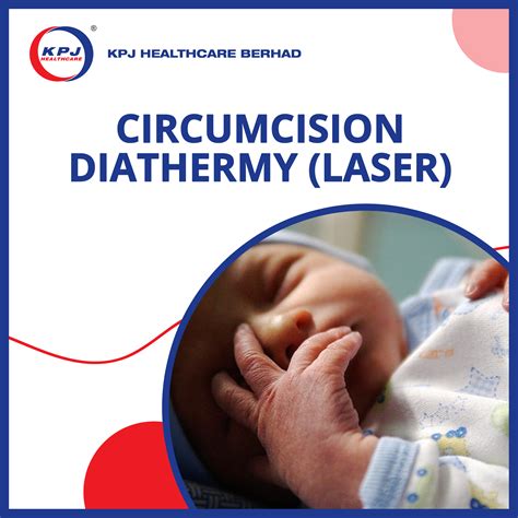 Dapatkan Kpj Acc Kinrara Circumcision Diathermy Laser Dengan Mudah Melalui Doctoroncall