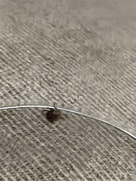 What Type Of Tick Is The Bite On The Scalp Bad Rticks