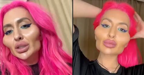 model with ‘world s biggest cheeks shows off her new surgery that makes her look even more extreme