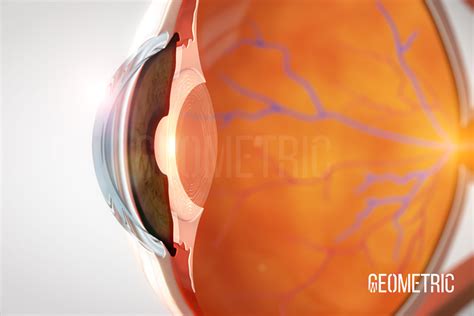 Crystalline Lens Illustration Geometric Medical Animation