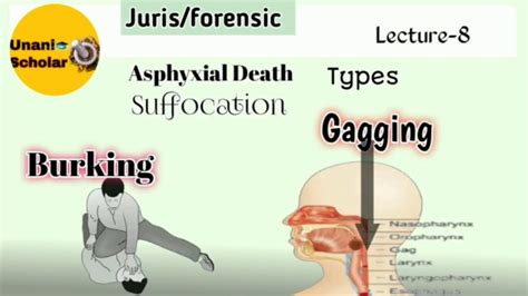 Asphyxial Deathsuffocation Typesgaggingburkingforensic Medicine