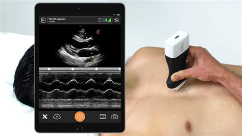 High Definition Handheld Ultrasound Scanner Available Now For Rapid