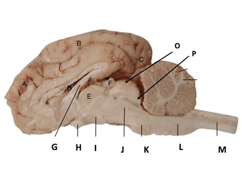 Sheep Brain Sagittal View