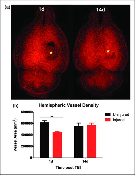 Tbi Results In Vascular Injury With Subsequent Repair A We Induced A